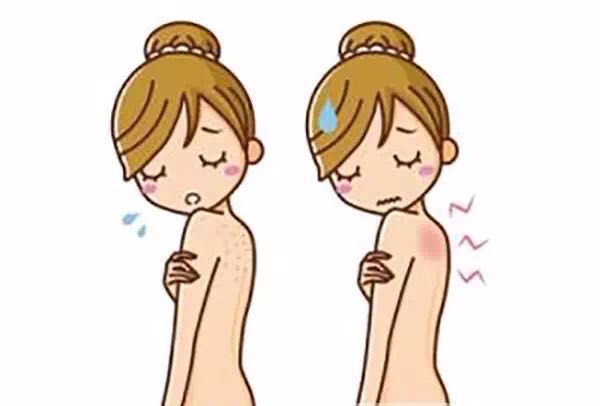 醉蠶：令人煩惱的濕疹，桑葚酒有妙方